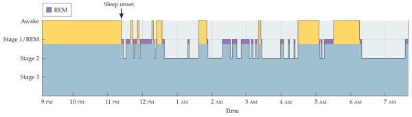 Refer to the figure showing the sleep pattern of a patient with depression. Patients with depression do not exhibit
