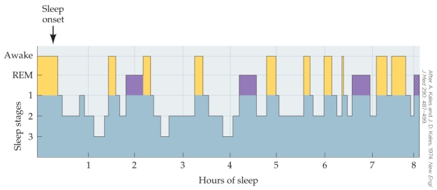 Refer to the figure, showing the typical sleep pattern of an elderly person. This pattern shown here is notable because of the
