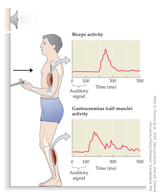 <strong>Refer to the figure. The experiment in the figure demonstrated that</strong> A) our behavior is the sum of reflexive responses to our environment. B) impulses travel faster through the motor neurons that innervate our calf muscles. C) a motor plan to stabilize our body precedes the pull of a lever. D) the reflex for pulling a lever is slower than the reflex for stabilizing the body.