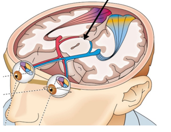<strong>Refer to the figure.   If a person sustained damage to the region indicated by the arrow in the figure,</strong> A) light information from the individual's retina would no longer reach their visual cortex. B) the individual would no longer be able to orient their gaze to see an object. C) the individual would be blind. D) the individual would only be able to see shadows and shades of light and dark. <div style=padding-top: 35px> 