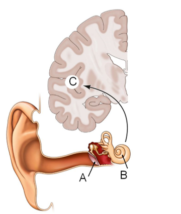 <strong>Refer to the figure.   Damage at area B in the figure could cause which kind of deafness?</strong> A) Cortical deafness B) Conduction deafness C) Word deafness D) Sensorineural deafness <div style=padding-top: 35px> 