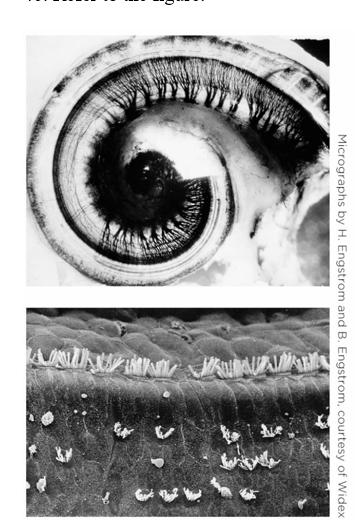 <strong>Refer to the figure.   This damage shown in these images might result in</strong> A) conduction deafness. B) sensorineural deafness. C) central deafness. D) word deafness. <div style=padding-top: 35px> 