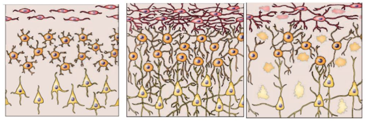 <strong>Refer to the figure, which shows several stages in nervous system development. Which process is occurring in the middle frame of the figure?</strong> A) Cell differentiation B) Cell death C) Synapse rearrangement D) Synaptogenesis