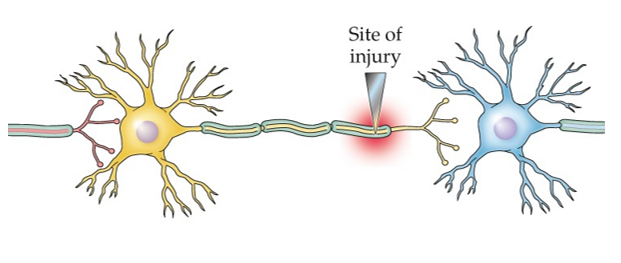 <strong>Refer to the figure. What is likely to happen to the peripheral neurons in the figure?</strong> A) The injured neuron will undergo retrograde degeneration, and the presynaptic and postsynaptic neurons will undergo transneuronal degeneration. B) The injured neuron will degenerate, and the presynaptic and postsynaptic neurons will likely be unaffected. C) The injured neuron will undergo Wallerian degeneration, and the presynaptic and postsynaptic neurons will likely undergo transneuronal degeneration. D) The presynaptic neuron will remain unchanged, the injured neuron will undergo anterograde degeneration and likely regenerate axons, which will be drawn to cell adhesion molecules released by the postsynaptic neuron.