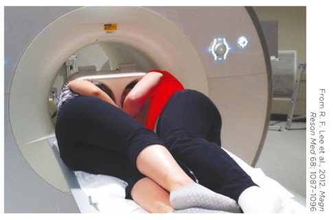 <strong>Refer to the photo. The procedure depicted here is most likely</strong> A) transcranial magnetic stimulation. B) DTI tractography. C) dyadic functional MRI. D) angiography.