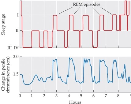 <strong>Refer to the figure. Based on the information in the graph, the nocturnal erections of a man who is temporarily unable to experience REM sleep would</strong> A) increase in number. B) decrease in number. C) decrease in number but increase in strength. D) increase in number but decrease in strength. E) cease until REM sleep was restored.