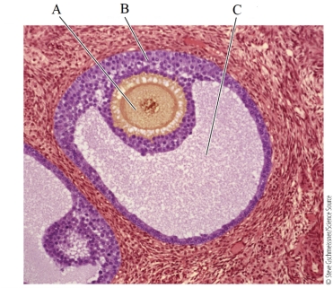 <strong>Refer to the figure. This is a microscopic view of an ovarian follicle. The correct labels for the lettered structures are</strong> A) A: ovum; B: supporting cells; C: cavity B) A: cavity; B: ovary; C: ovum C) A: ovum; B: oviduct; C: os D) A: ovary; B: supporting cells; C: ovum E) A: os; B: ovum; C: fimbria