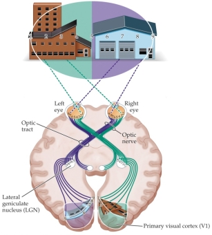 Refer to the figure. Using the number labels in shown the visual fields of the figure, list which parts of the visual field would be affected by a lesion in right optic tract (marked in red).