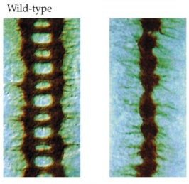Refer to the figure. In a wild-type Drosophila, some axons (stained brown) cross over the midline and some project longitudinally on either side of it, forming a ladder-like pattern of axons. In the image on the right, all axons are bundled at the midline. What mutation could have caused the abnormal axonal projection pattern in the right-hand image?