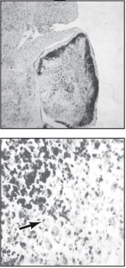 Refer to the figure. The figure shows a photomicrograph of the cerebellum of a mouse with a reeler mutation. The granule cells are darkly stained and a representative Purkinje cell is denoted with an arrow. Describe the organization of the Purkinje and granule cells in this mutant mouse compared to a wild-type mouse.