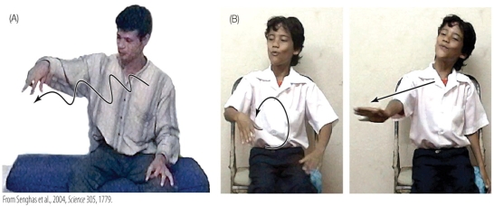 Refer to the figure. Figure A demonstrates how a hearing individual might use a gesture, along with speech, to describe rolling downhill. Figure B demonstrates how someone using sign language might gesture to convey the same action. What do the images tell us about how each individual uses gestures to convey information? Why is this an important distinction in linguistics, and how does it allow sign languages to resemble spoken languages in terms of their expressive power?
