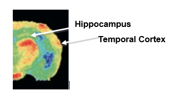 <strong> In the image above is an autoradiograph of the left hemisphere of a mouse brain after radioactive 2-DG injections taken after the mouse had just completed a memory test in an 8-arm radial maze. Would you assume this mouse had just started training or was several days into the training to remember which arm contained food?</strong> A) just started training B) several days into training C) the autoradiograph can not be used to determine this D) somewhere between the first and last days of training