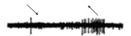 <strong>Which stimuli directionality would you expect to elicit the response of the above V1 neuron recording below? </strong> A) B) C)
