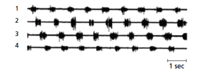 <strong>  The image above showing neural activity in four electrodes placed opposite each other, 1 across from 3 and 2 across from 4, in sequence in a spinal cord. Which of the following can be derived from this data?</strong> A) activity in electrode 1 seems to inhibit activity in electrode 3 and visa versa, indicative of the rhythmic activity of lateral undulation B) activity in electrode 1 seems to inhibit activity in electrode 2 and visa versa, indicative of the rhythmic activity of lateral undulation C) activity in electrode 2 seems to inhibit activity in electrode 3 and visa versa, indicative of the rhythmic activity of active swimming D) All of these neural activity recorded is inhibitory E) There is no pattern of activity that can be derived from reviewing this data <div style=padding-top: 35px> 