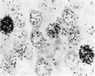 <strong>The picture below is a hippocampal section from an animal injected with tritiated thymidine shortly after birth and sacrificed two weeks later. What can you conclude from this image? </strong> A) no cell division has occurred during this two-week period of time B) the rate of cell division seems to be slower than before birth C) the presence of radioactive thymidine in the image indicates DNA synthesis has occurred D) all of the cells in the image are neurons E) all of the above