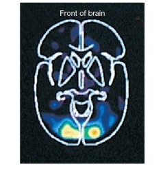 <strong>Refer to the figure below.   This mean difference image shows the most active brain areas across participants when they are completing a specific task. If lighter areas mean greater brain activity, what task were participants most likely completing?</strong> A) Speaking B) Listening to music C) Touching something with a rough texture D) Looking at an image <div style=padding-top: 35px> 