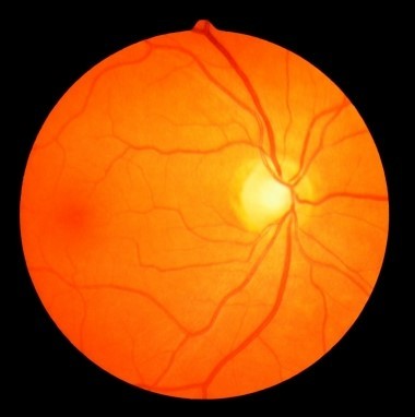 <strong>Refer to the figure. Eye doctors use an instrument called an ophthalmoscope to look at the _______ of their patients' eyes, as seen in the image.</strong> A) cornea B) iris C) lens D) focal point E) fundus