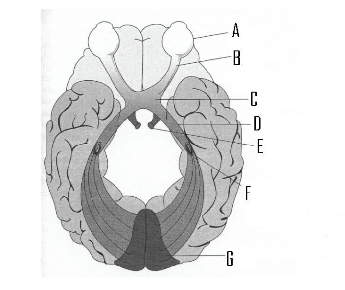 The figure below shows the parts of the visual pathway from the eye to the brain.     -Identify the lateral geniculate nucleus.