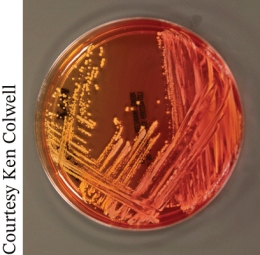 <strong>The photo shows growth of a nasal specimen overnight on Mannitol salt agar. This result shows the pathogen is most likely </strong> A) Staphylococcus aureus B) MRSA C) Closteroides difficile D) Pseudomonas aeruginosa