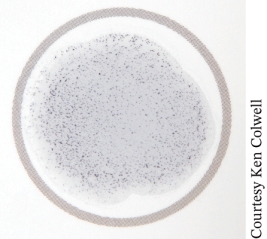 <strong>The photo of a coagulase agglutination test is ____________________ and is used to confirm diagnosis of ________________________. </strong> A) negative; Staphylococcus aureus B) positive; Staphylococcus aureus C) negative; Staphylococcus epidermidis D) positive; Staphylococcus epidermidis