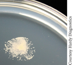 <strong>The photo shows the result of suspending a coagulase positive colony on a Muller-Hinton agar plate containing 4% oxacillin. The colony was from a nasal swab and produced a yellow colony growing on mannitol salt agar. This results confirms identification of the bacteria as </strong> A) Staphylococcus aureus B) MRSA C) Closteroides difficile D) Pseudomonas aeruginosa