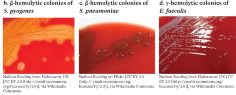 <strong>A pathogen that has the growth pattern shown in the photo when grown on blood agar is </strong> A) Streptococcus pyogenes B) Streptococcus pneumoniae C) Enterococcus faecalis D) Staphylococcus epidermidis