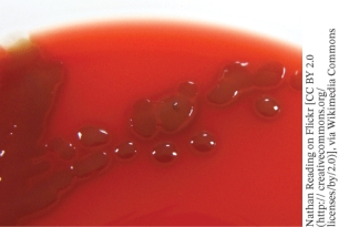 <strong>A pathogen that has the growth pattern shown in the photo when grown on blood agar is </strong> A) Streptococcus pyogenes B) Streptococcus pneumoniae C) Enterococcus faecalis D) Staphylococcus aureus