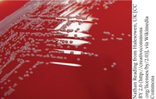 <strong>A pathogen that has the growth pattern shown in the photo when grown on blood agar is </strong> A) Streptococcus pyogenes B) Streptococcus pneumoniae C) Enterococcus faecalis D) Staphylococcus aureus