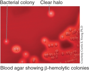 <strong>An example of a bacterial species that shows the growth pattern seen below is ________. </strong> A) Streptococcus pyogenes B) Streptococcus pneumoniae C) E. coli D) Salmonella