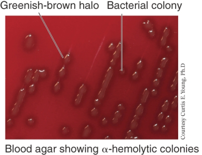 <strong>An example of a bacterial species that shows the growth pattern seen below is ________. </strong> A) Streptococcus pyogenes B) Streptococcus pneumoniae C) E. coli D) Salmonella