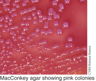 <strong>An example of a bacterial species that shows the growth pattern seen below is ________. </strong> A) Streptococcus pyogenes B) Streptococcus pneumoniae C) E. coli D) Salmonella