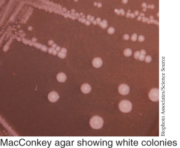<strong>An example of a bacterial species that shows the growth pattern seen below is ________. </strong> A) Streptococcus pyogenes B) Streptococcus pneumoniae C) E. coli D) Salmonella