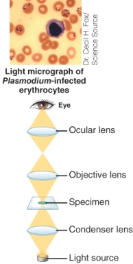 <strong>The image below represents a(n): ________. </strong> A) Dark field microscope B) Bright field microscope C) Fluorescence microscope D) Phase contrast microscope
