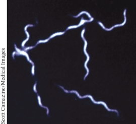 <strong>What type of microscope was used to produce the image below? </strong> A) Dark field microscope B) Bright field microscope C) Fluorescence microscope D) Phase contrast microscope