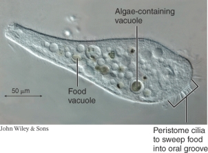<strong>What type of microscope was used to produce the image below? </strong> A) Differential interference contrast microscopy B) Bright field microscope C) Fluorescence microscope D) Confocal microscope