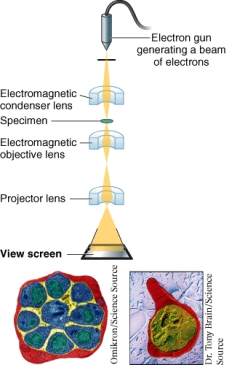 <strong>What type of microscope is shown below? </strong> A) Bright field microscope B) Transmission electron microscope C) Fluorescence microscope D) Dark field microscope