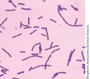 <strong>The bright field light micrograph below is an image of: ________. </strong> A) gram positive bacterial cells B) gram negative bacterial cells C) acid fast bacterial cells D) bacterial cells with endospores