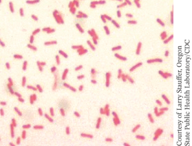 <strong>The bright field light micrograph below is an image of: ________. </strong> A) gram positive bacterial cells B) gram negative bacterial cells C) acid fast bacterial cells D) bacterial cells with endospores