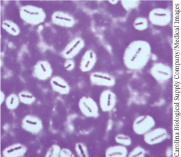 <strong>The light micrograph below is an example of: ________. </strong> A) A capsule stain B) An acid fast stain C) An endospore stain D) Dark field microscopy