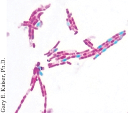 <strong>The light micrograph below is an example of: ________. </strong> A) A capsule stain B) An acid fast stain C) An endospore stain D) A Gram stain