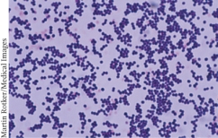 <strong>Examine the micrograph and determine what features can be used to identify this potential pathogen. (Select all that apply) </strong> A) Color B) Shape C) Number D) Arrangement