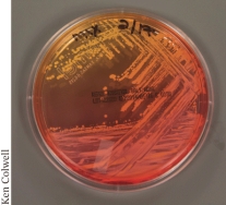 <strong>Culture media, such as the example shown below, help identify microbial specimens in the laboratory because they contain ________. </strong> A) additional protein B) a buffer to maintain the pH C) indicator dyes D) reduced salts to adjust the osmotic environment