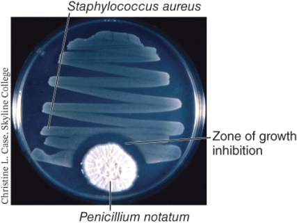 <strong>Examine the photo below and determine which of the following statements is accurate. (Select all that apply) </strong> A) The zone of growth inhibition is an example of antibiosis. B) The Staphylococcus aureus is secreting an antibiotic compound. C) The growth of Penicillium notatum is being inhibited by the secretions of the Staphylococcus aureus. D) It is clear that the Staphylococcus aureus is resistant to the inhibitory chemicals secreted by the Penicillium notatum.