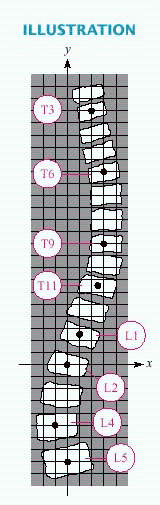 <strong>Scoliosis is a lateral curvature of the spine that can be more easily detected when a grid is superimposed over an X ray. Select the ordered pair that is not one of the center points of the labeled vertebrae. Note that T3 means the third thoracic vertebra, L4 means the fourth lumbar vertebra, and so on. </strong> A) B) C) (3,10) D) (3,16) E) (0,0)