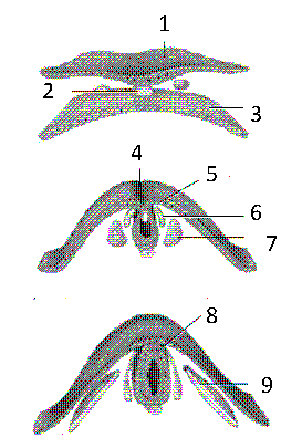 Figure 51-4 . Refer to the accompanying figure. The structure labeled as 2 is the: