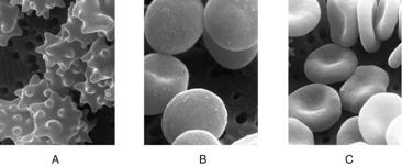 Labeling These micrographs show the effects of various aqueous environments on red blood cells. Identify the correct environment depicted in each panel.