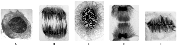 <strong>    Answer the following questions using the accompanying figure. Figure 10.1 Identify the stage of mitosis shown in panel E. ​</strong> A)interphase B)prophase C)metaphase D)anaphase E)telophase <div style=padding-top: 35px> 