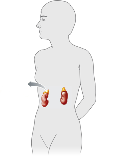 <strong> Figure 42.4 Answer the question using the accompanying figure. The ____ glands are shown in this figure. </strong> A)thyroid B)pituitary C)adrenal D)pancreatic E)pineal