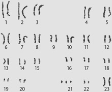 <strong> Figure 13.5a Which genetic condition is revealed in the karyotype display shown in the accompanying figure?</strong> A) Turner syndrome B) Down syndrome C) cri-du-chat D) Triple-X syndrome E) Klinefelter syndrome