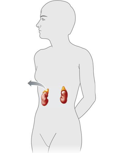 <strong> Answer the question using the accompanying figure. The ____ glands are shown in this figure.</strong> A) thyroid B) pituitary C) adrenal D) pancreatic E) pineal